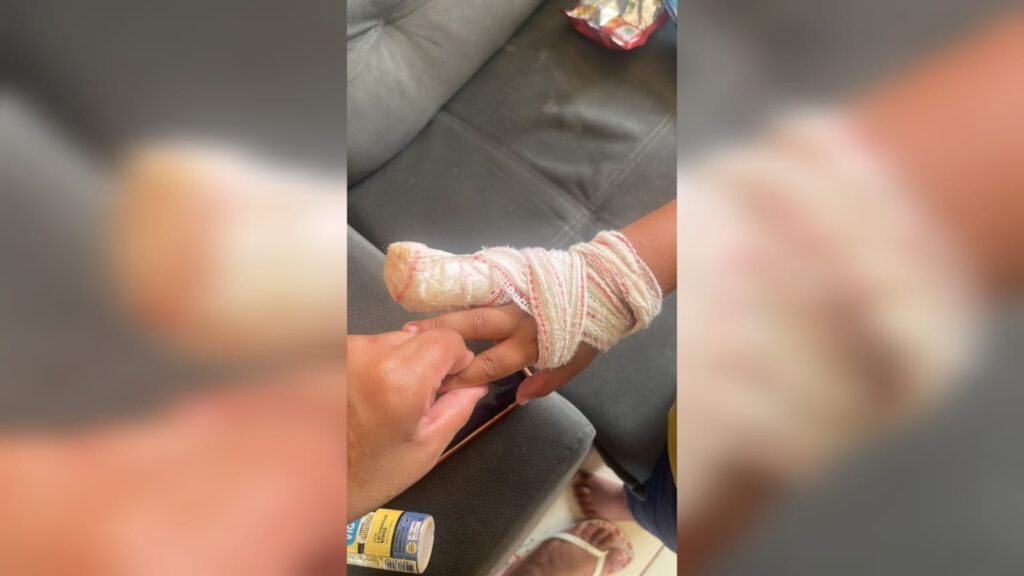 Criança de 4 Anos Sofre Amputação Após Acidente em Creche de Sorocaba Criança de 4 Anos Sofre Amputação Após Acidente em Creche de Sorocaba