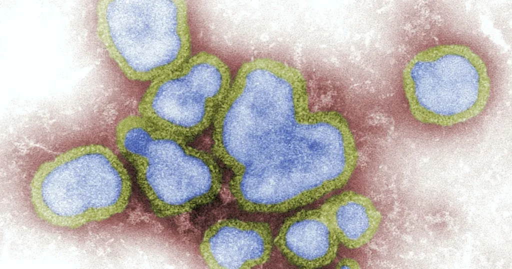 Sorocaba Confirma 2ª Morte por Influenza em 2026 - Dados Alarmantes