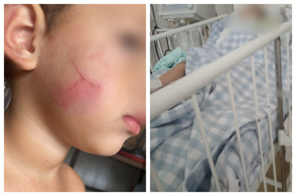 Bebê Internado em UTI: Agressão de Babá Relatada pelo Irmão de 3 Anos Bebê Internado em UTI: Agressão de Babá Relatada pelo Irmão de 3 Anos