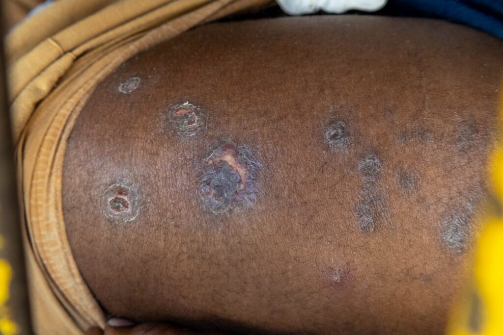 Um Detento Morre a Cada 19 Horas em SP: A Crise da Saúde no Sistema Penal