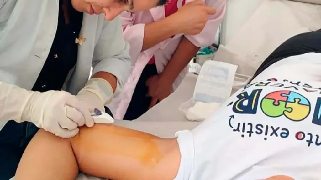 Implante contraceptivo no Paraná cresce 380% em 2026 e revoluciona o planejamento familiar